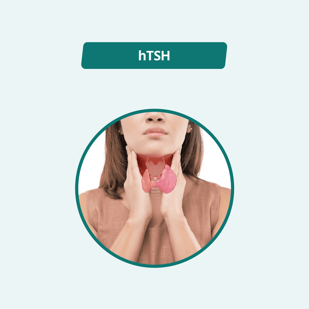Thyroid Stimulating Hormone (TSH)