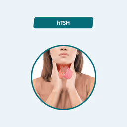 Thyroid Stimulating Hormone (TSH)
