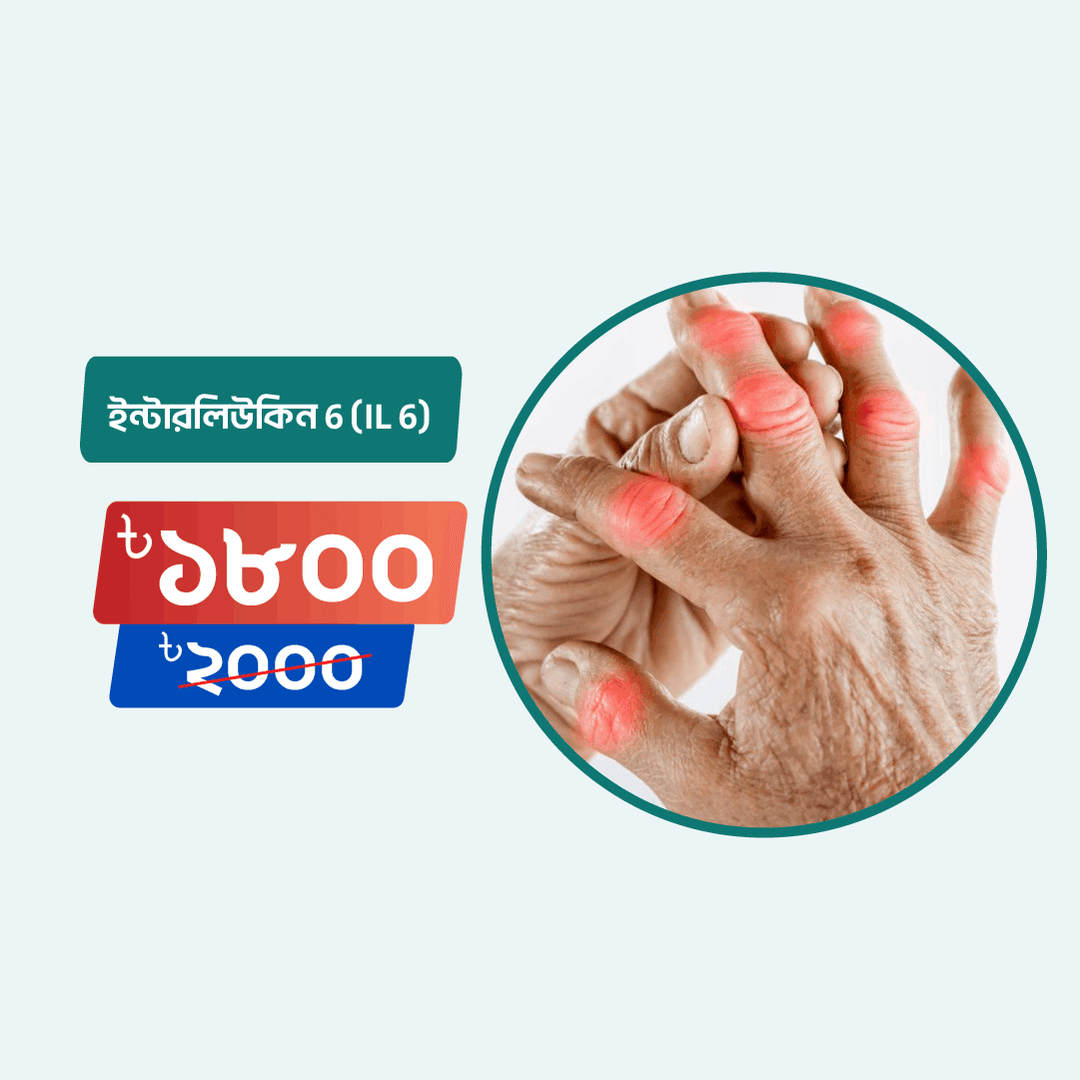 Interleukin 6 (IL 6)