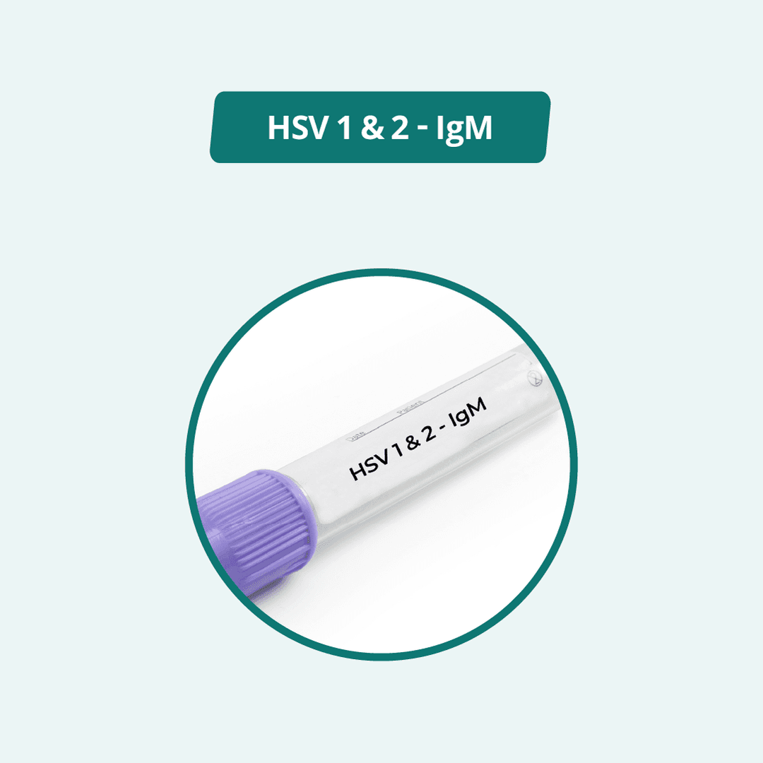 HSV 1 & 2 - IgM