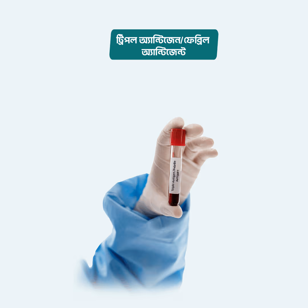 Febrile Antigens