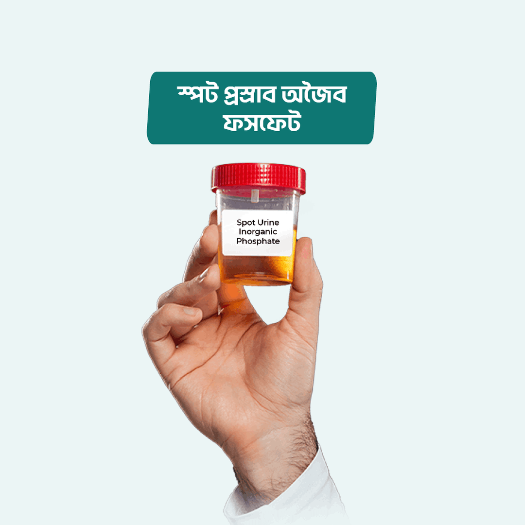 Spot Urine Inorganic Phosphate