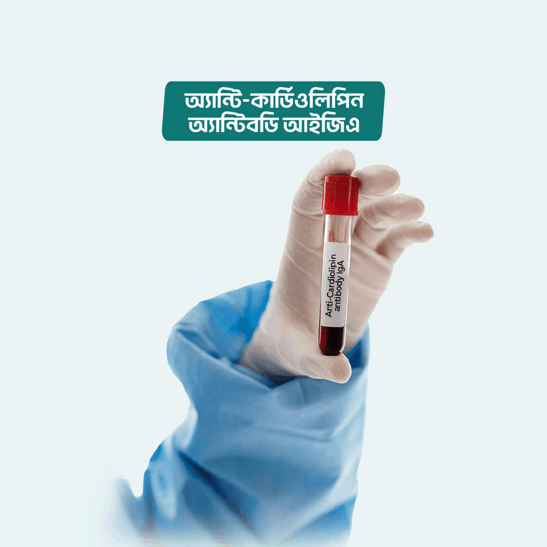 Anti-Cardiolipin antibody (IgG IgM)