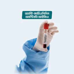 Anti-Cardiolipin antibody (IgG IgM)