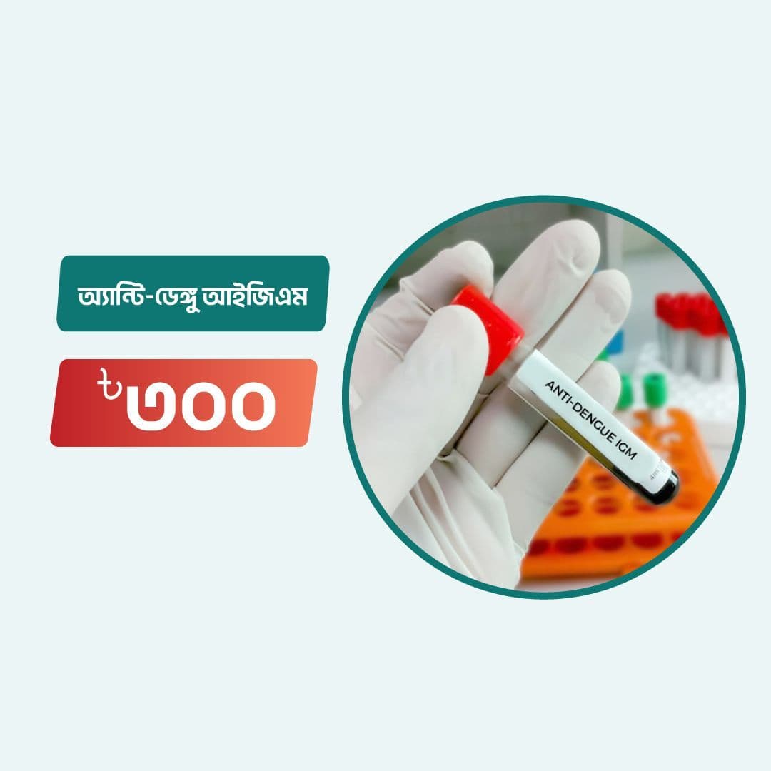 Anti-Dengue IgM