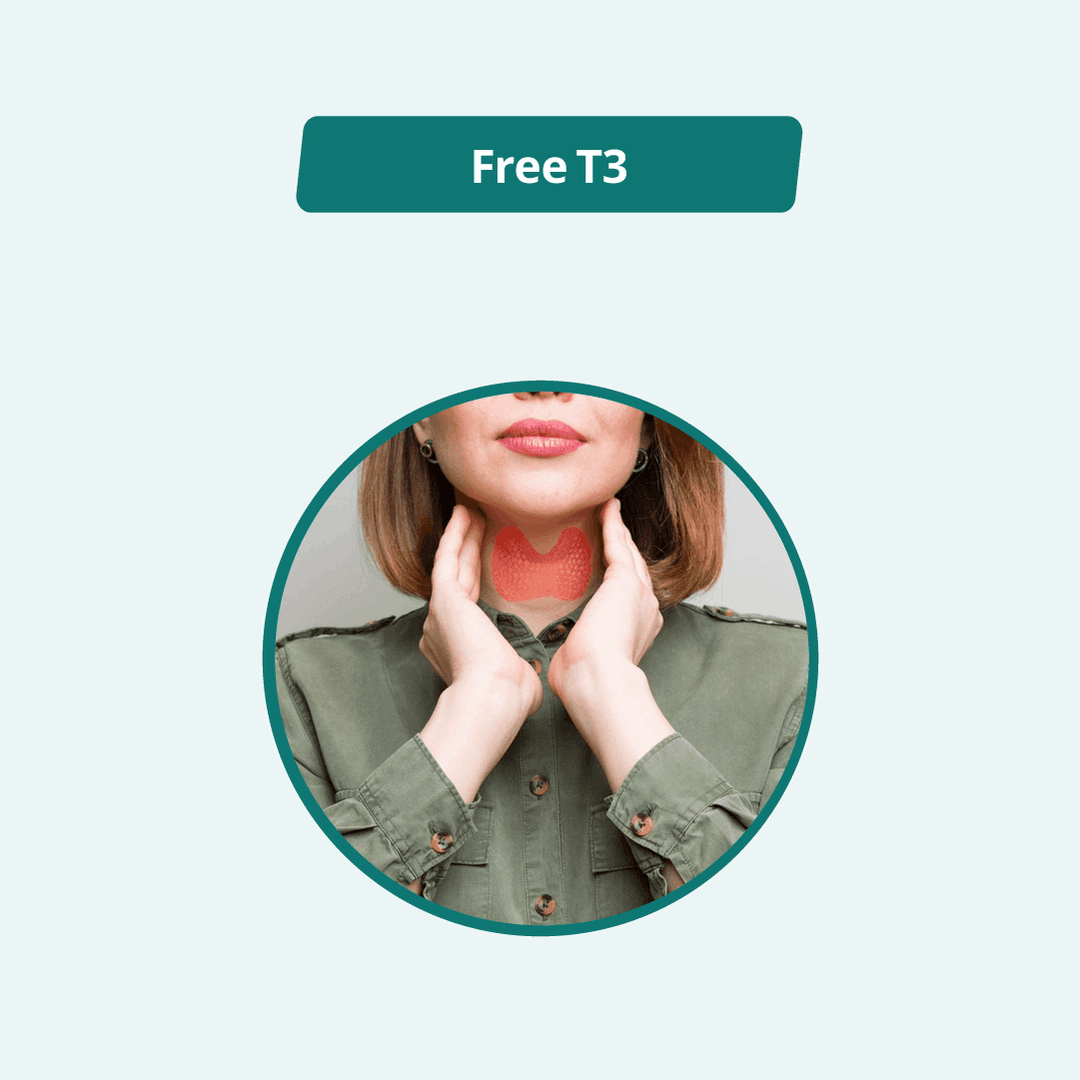 Free T3 (FT3)