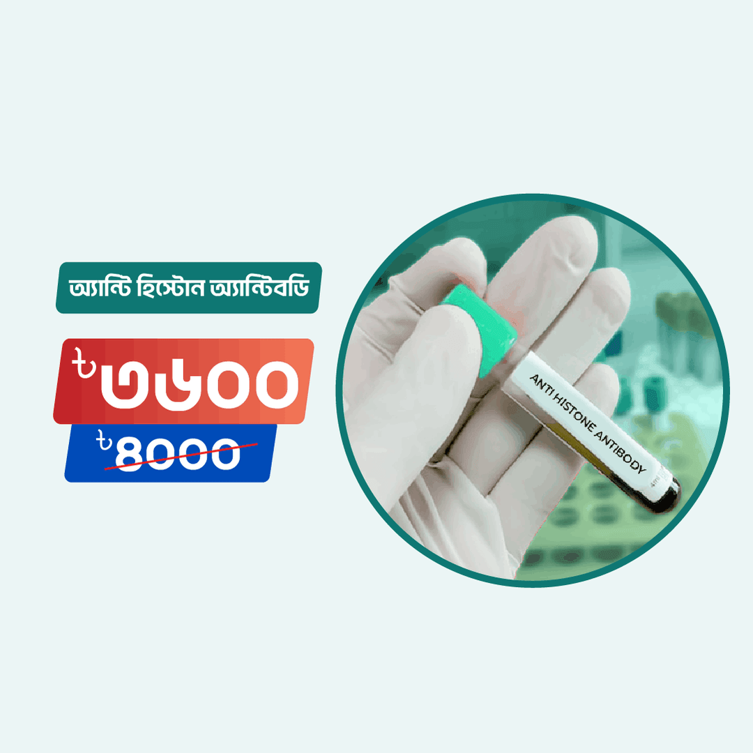 Anti Histone Antibody