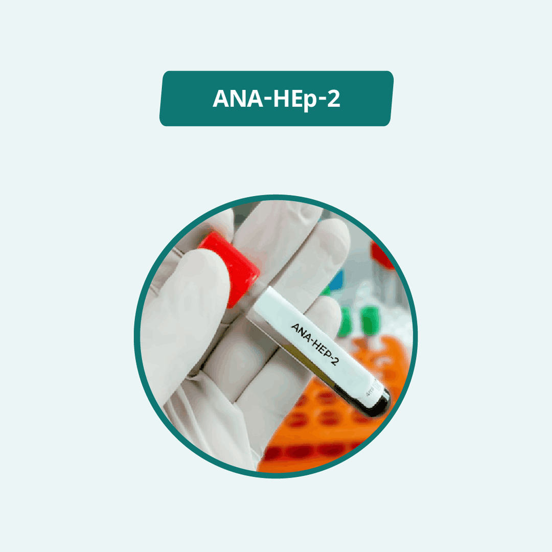 ANA-HEp-2
