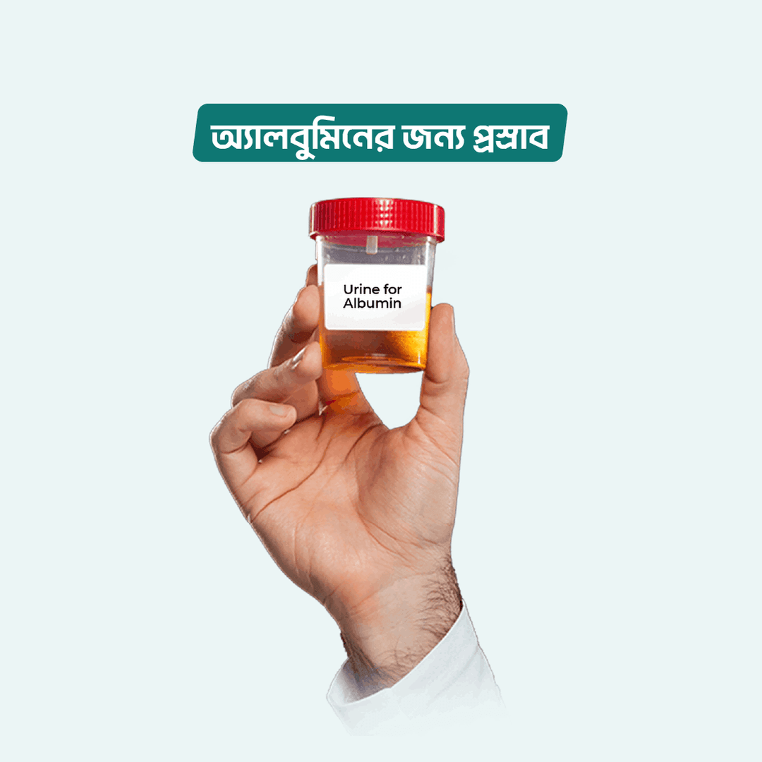 Urine for Albumin