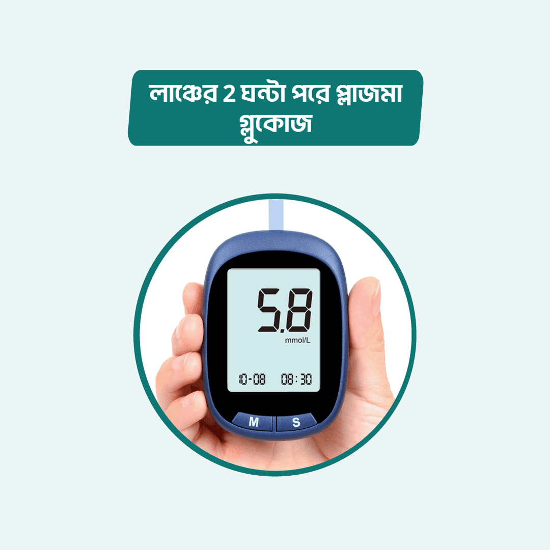 Plasma glucose 2 hrs after lunch