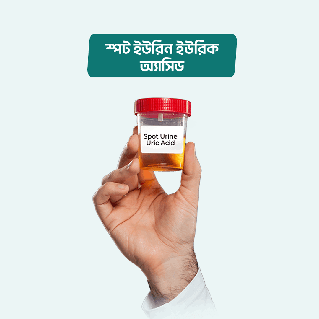 Spot Urine Uric Acid