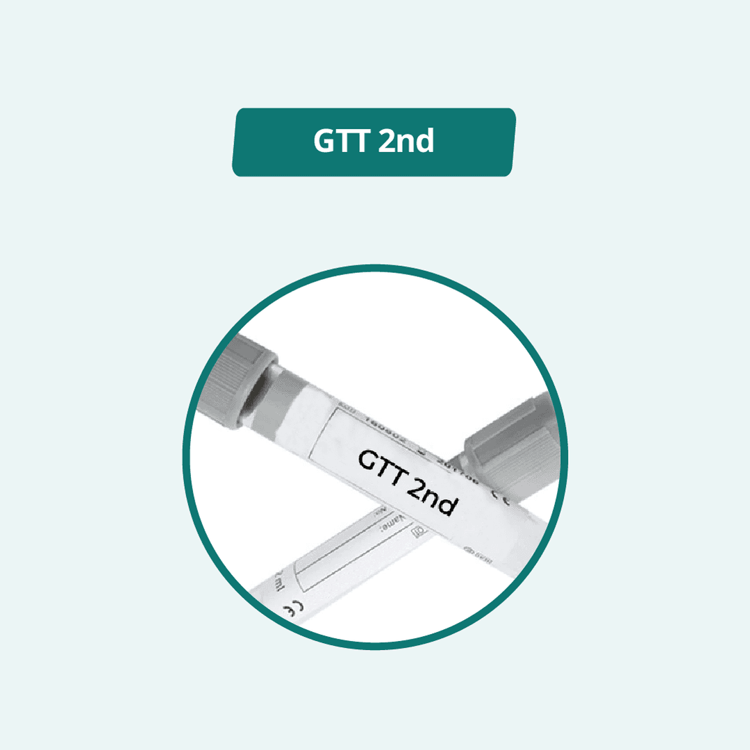 GTT 2nd