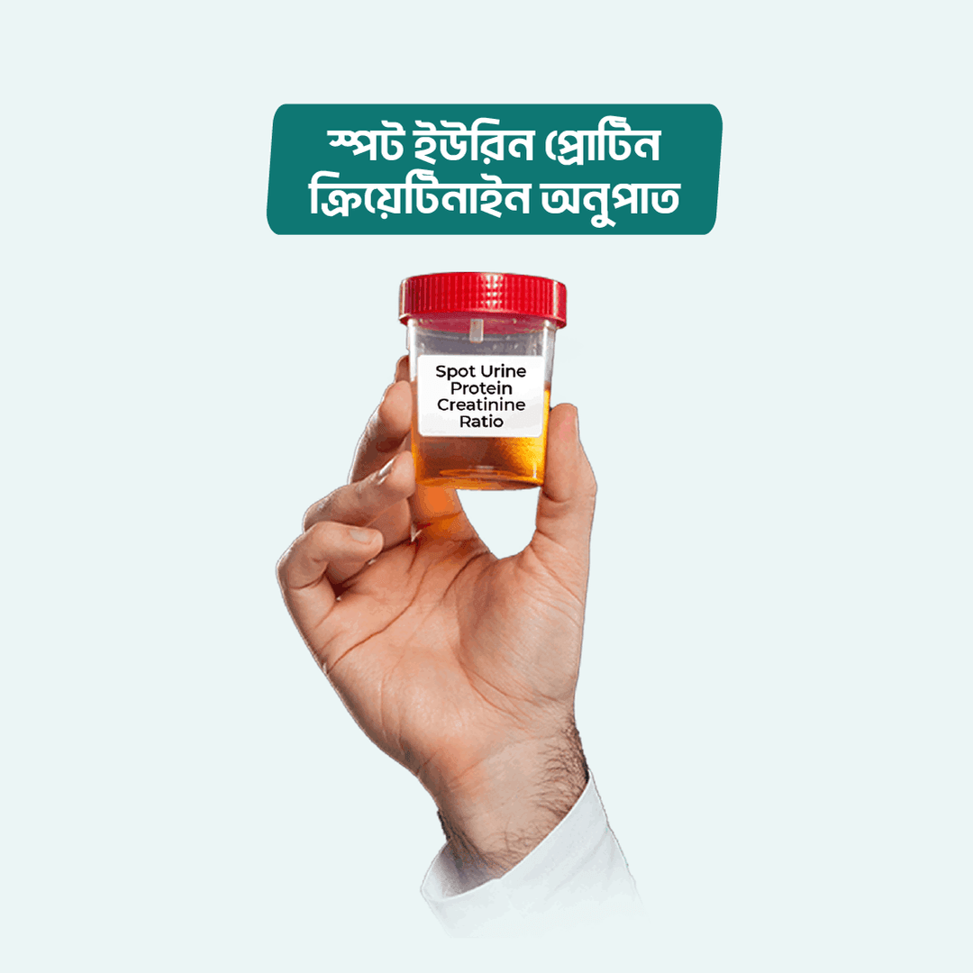 Spot Urine Protein Creatinine Ratio