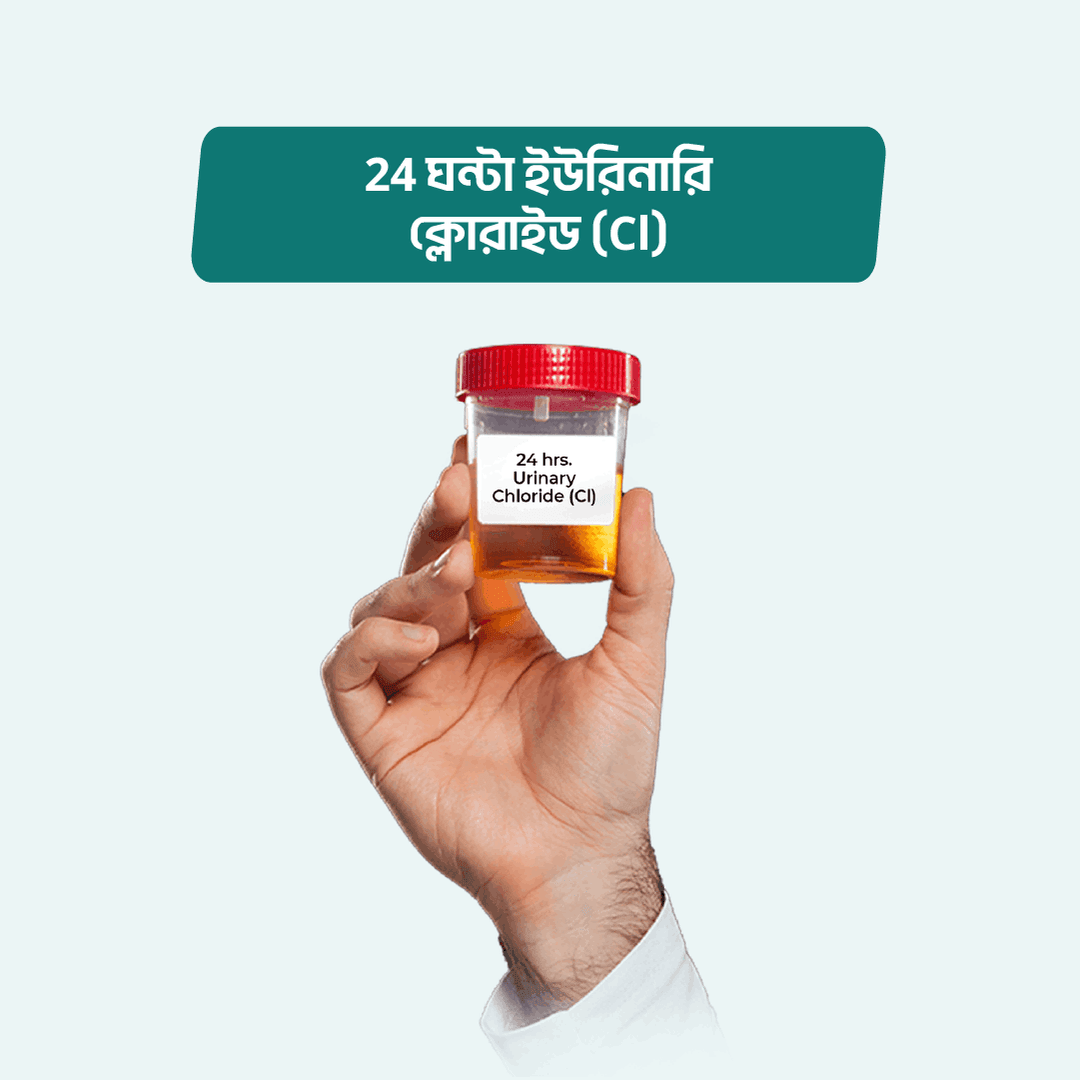 24 hrs. Urinary Chloride (Cl)