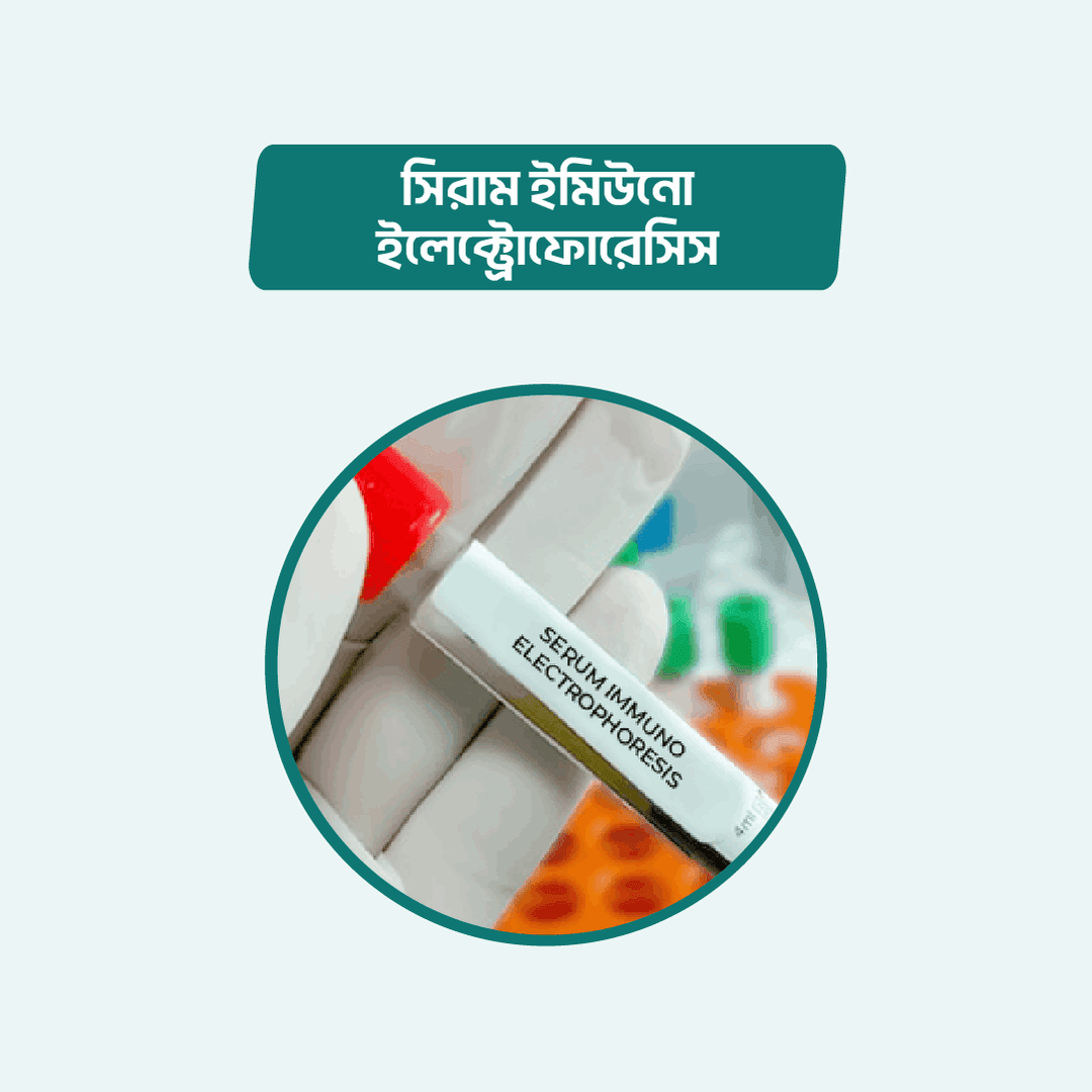 Serum Immuno Electrophoresis