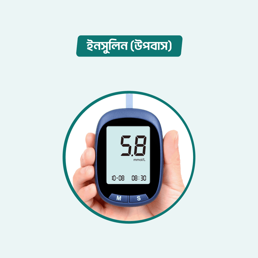 Insulin (Fasting)