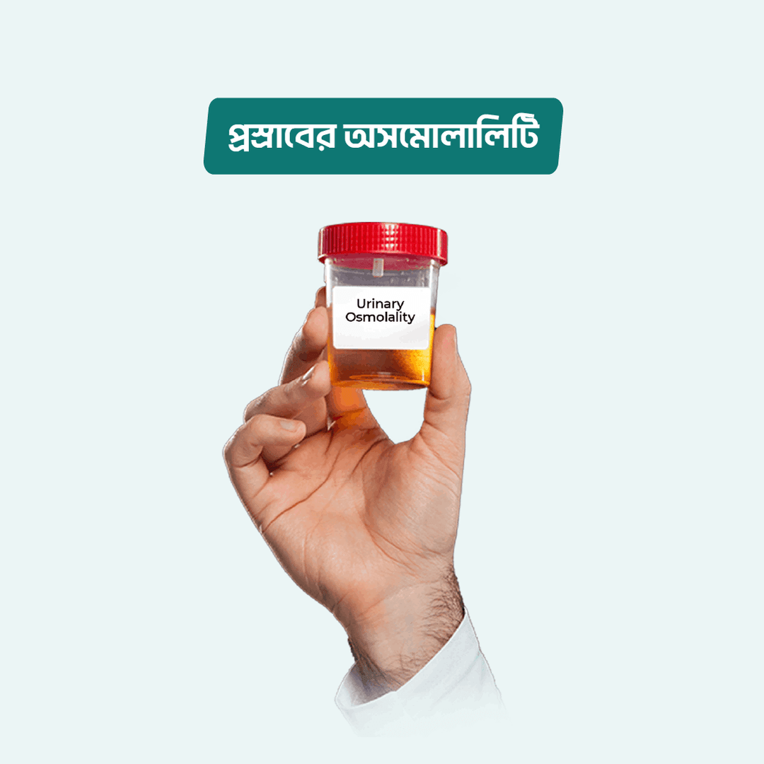 Urine for Microalbumin