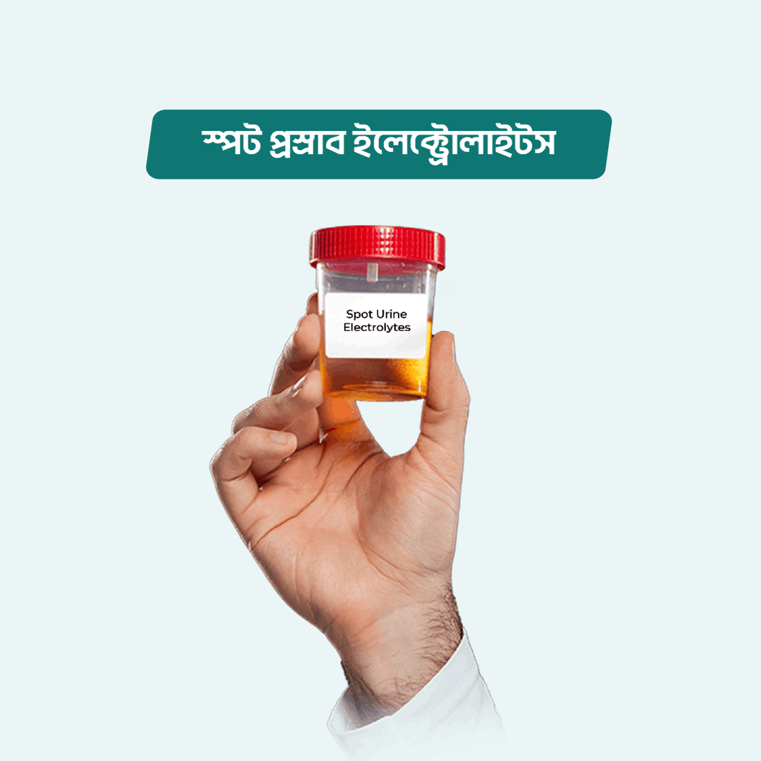 Spot Urine Electrolytes/Electrolytes Urine