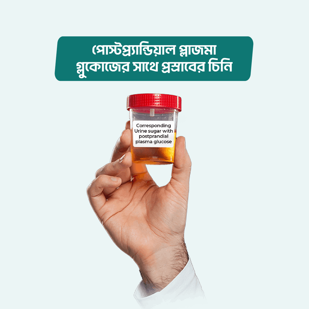 Corresponding Urine sugar with postprandial plasma glucose