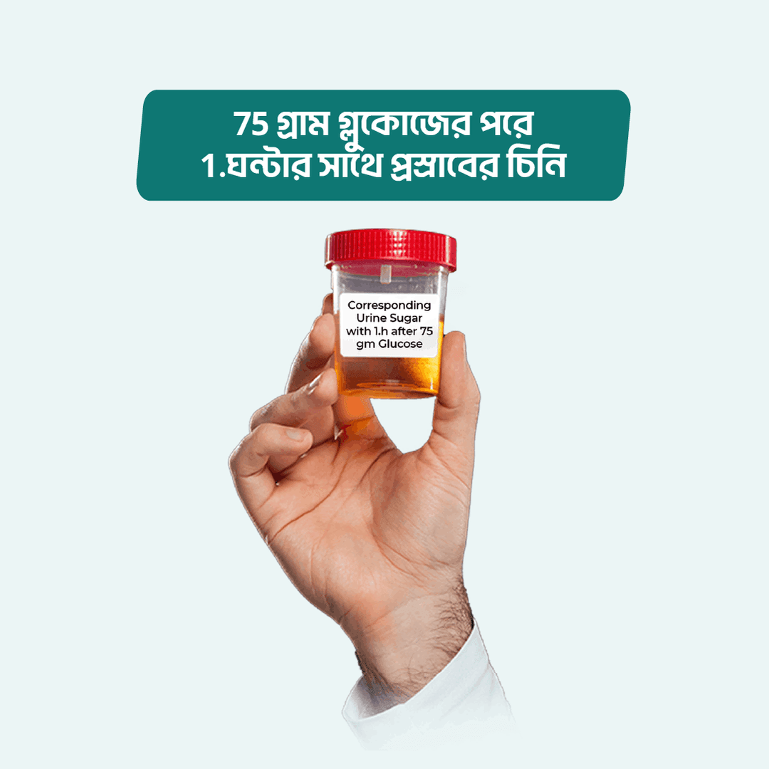 Corresponding Urine Sugar with 1.h after 75 gm Glucose