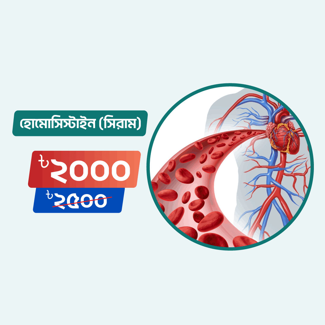 Homocysteine (Serum)