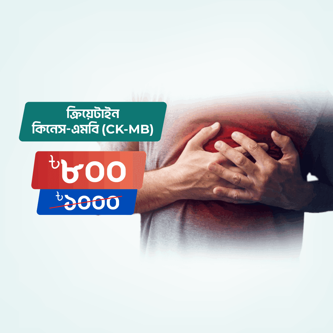 Creatine Kinase-MB (CK-MB)