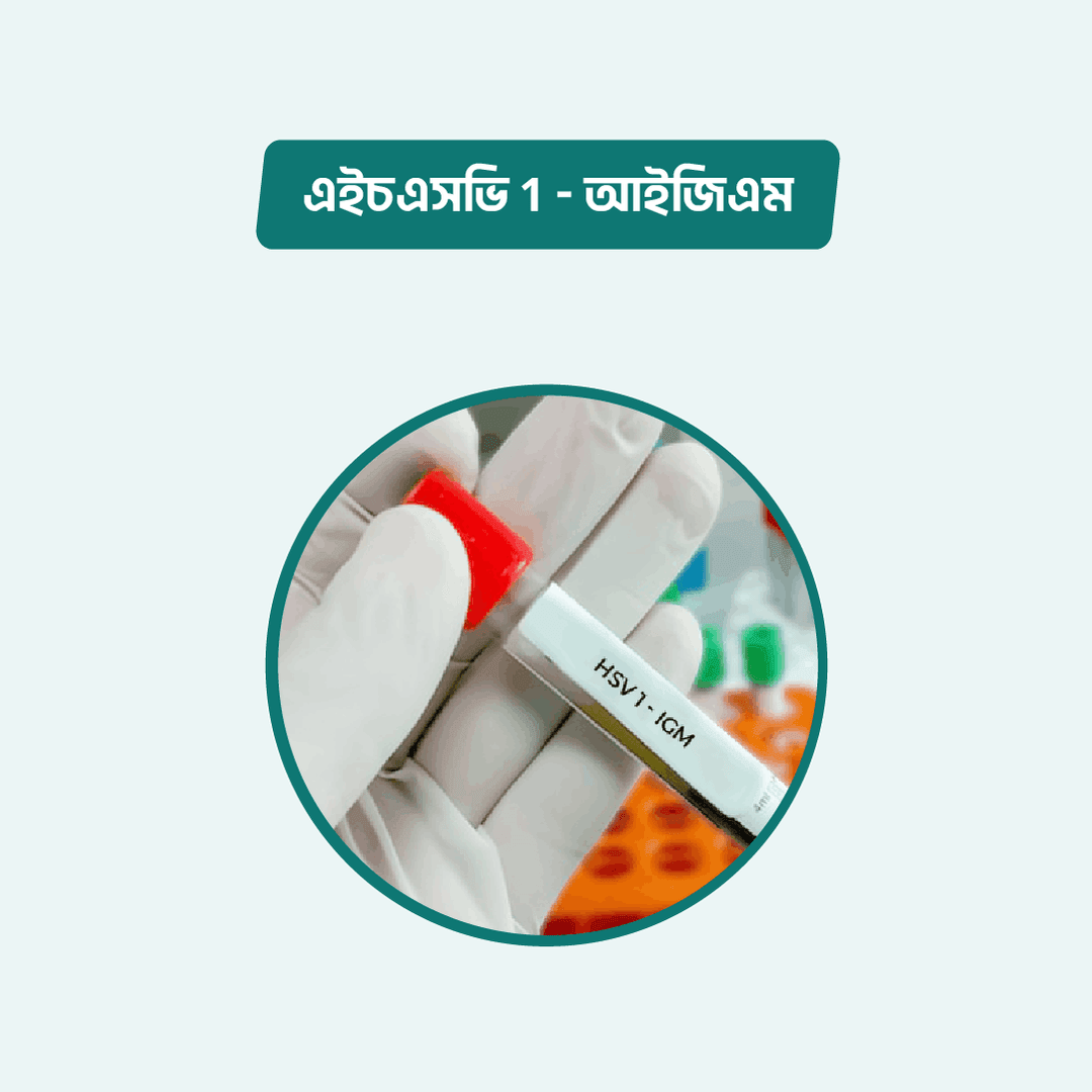 HSV 1 - IgM