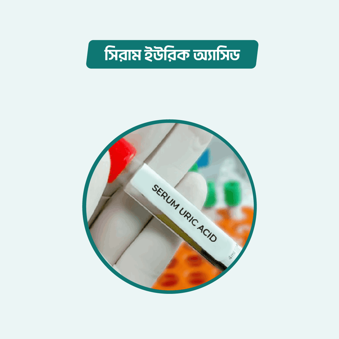 Serum Uric Acid