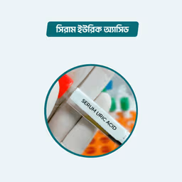Serum Uric Acid