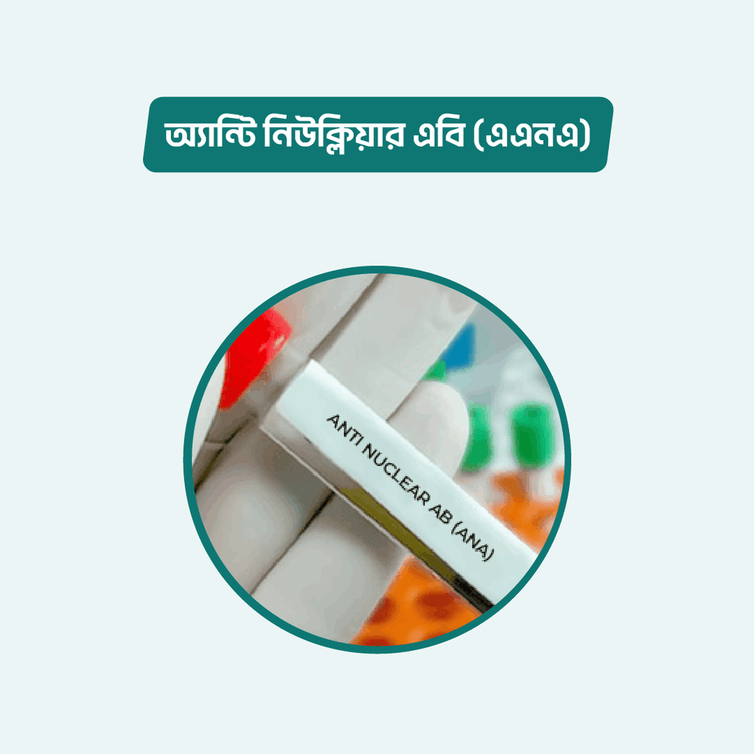 Anti Nuclear Ab (ANA)