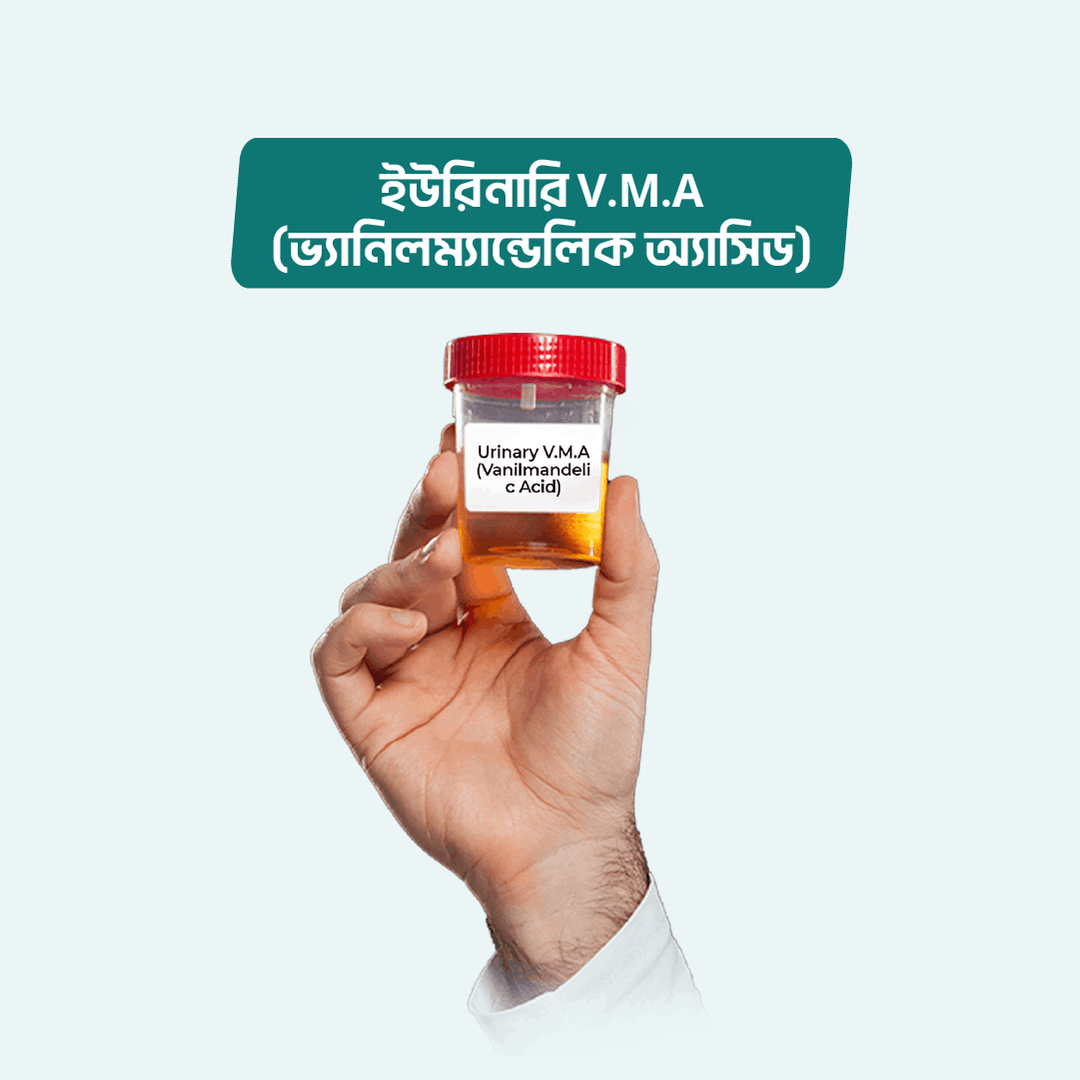 Urinary V.M.A (Vanilmandelic Acid)