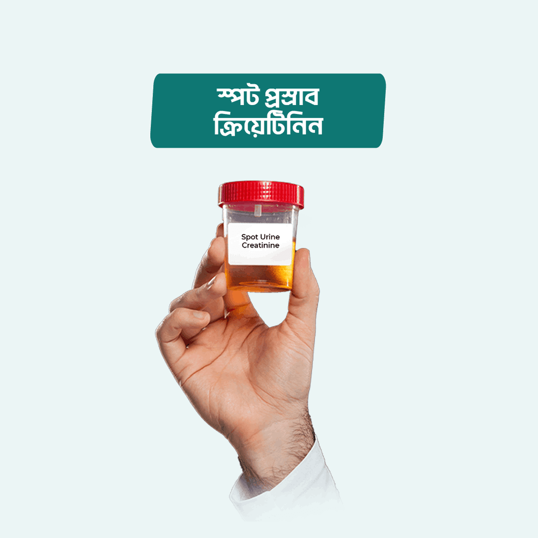 Spot Urine Creatinine