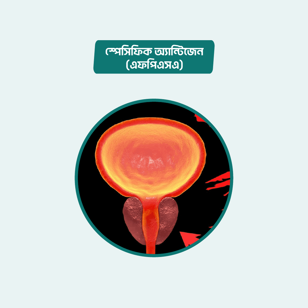 Prostate-Specific Antigen (Free) (FPSA)