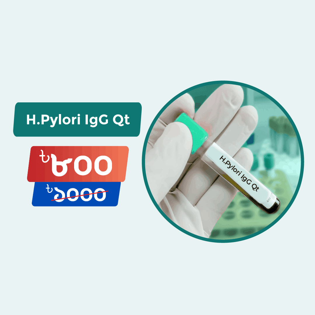 H.Pylori IgG Qt