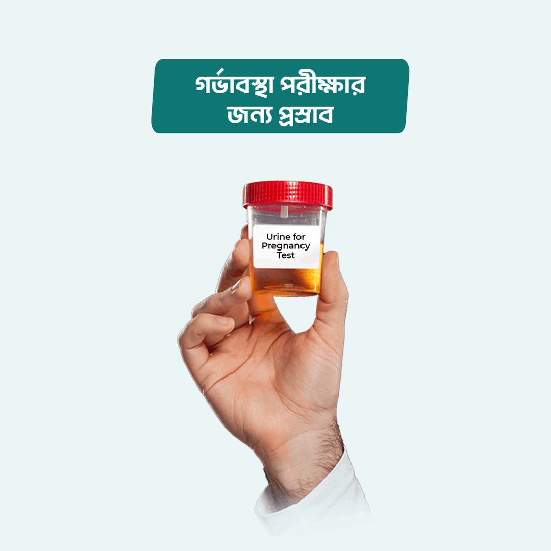 Urine for Pregnancy Test