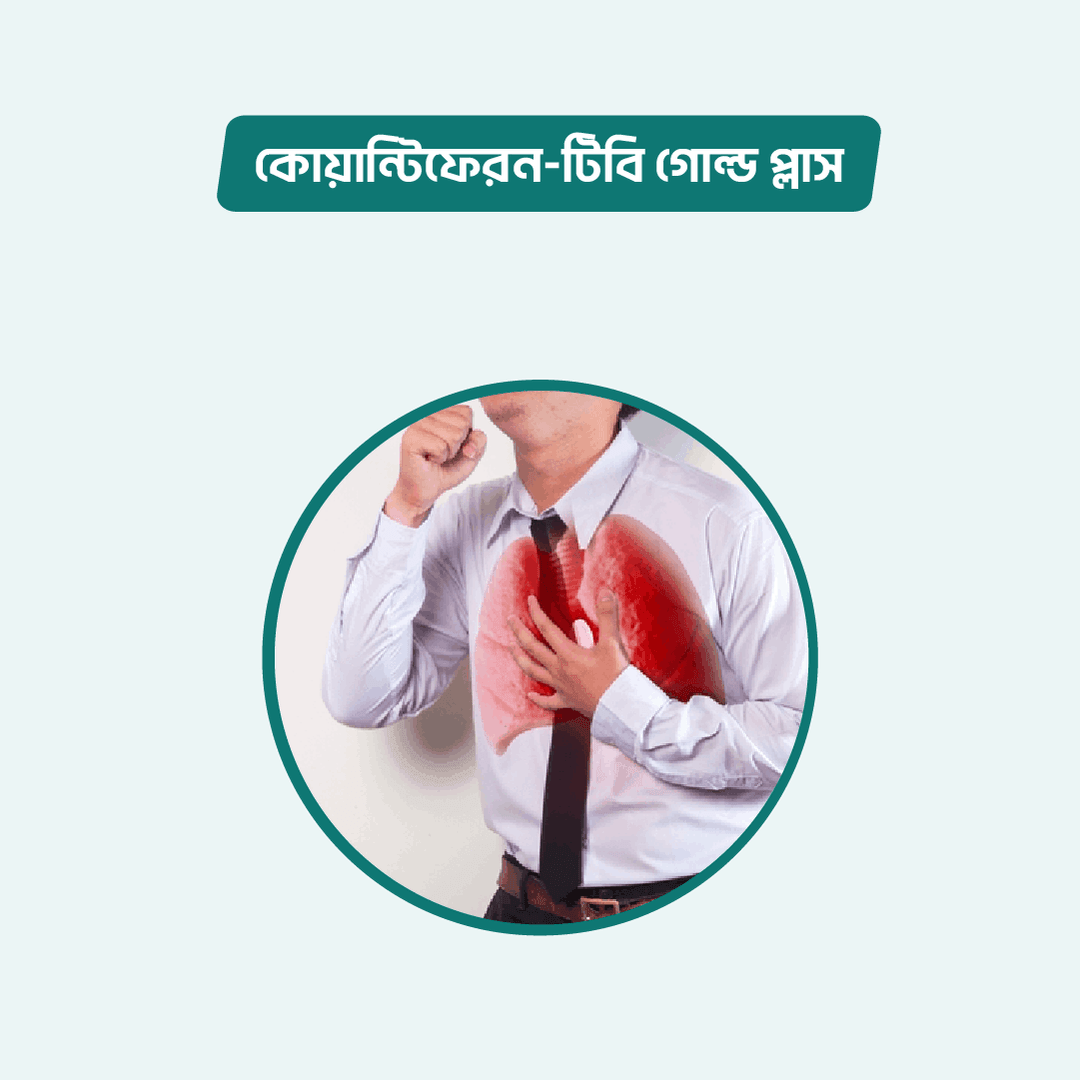 QuantiFERON-TB Gold Plus