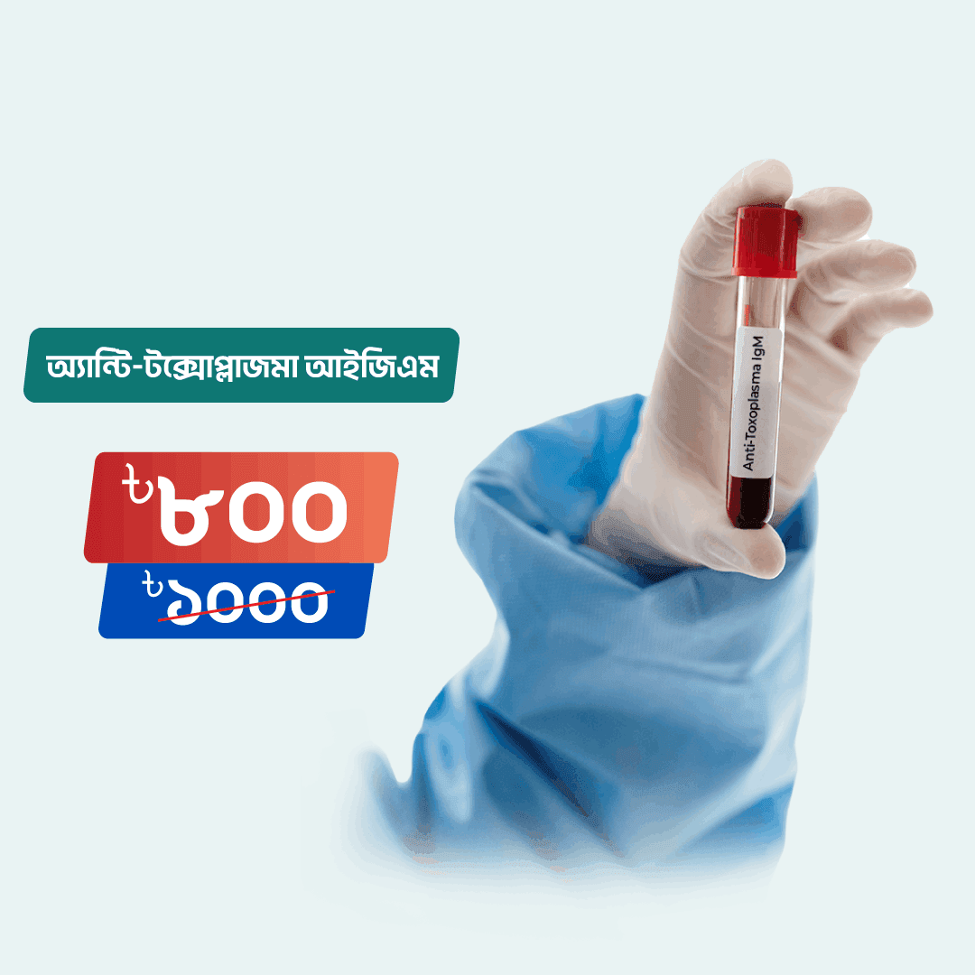 Anti-Toxoplasma IgM