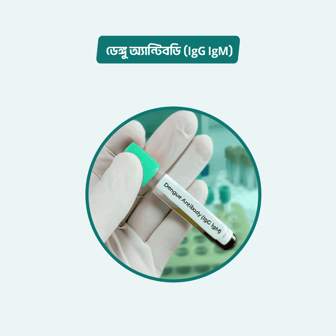 ICT for Dengue Antibodies: (IgG & IgM)