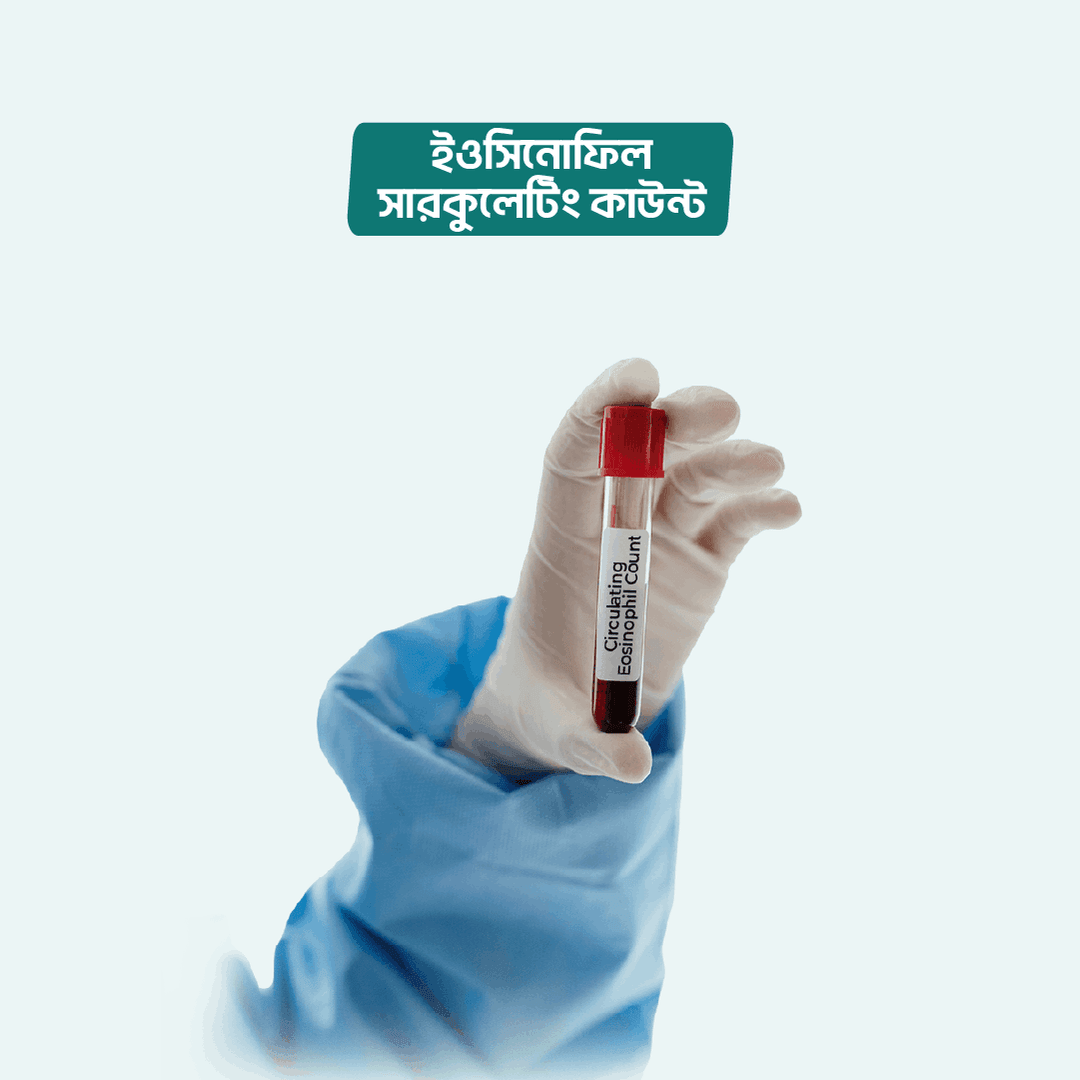 Circulating Eosinophil Count