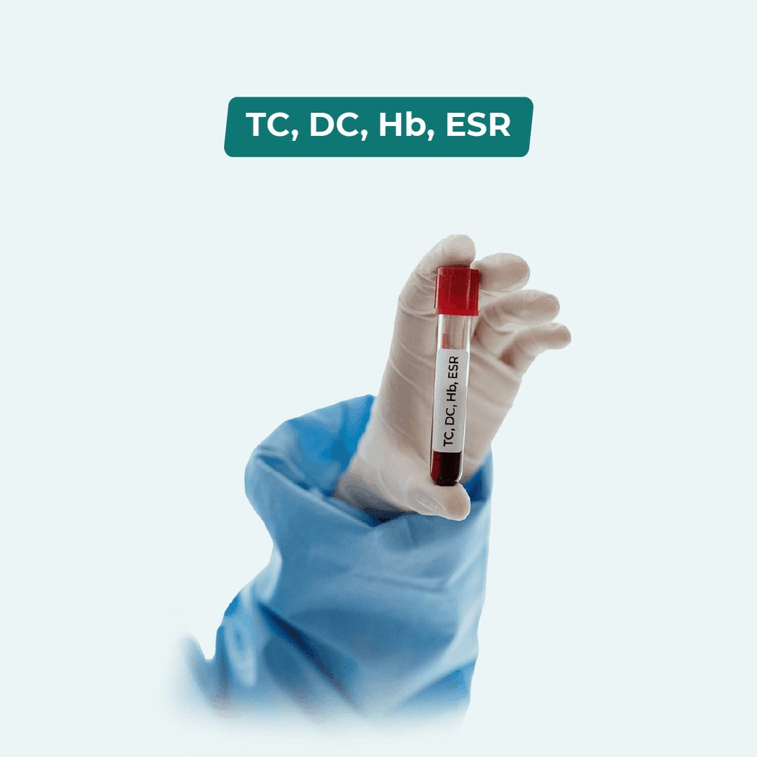 TC, DC, Hb%, ESR