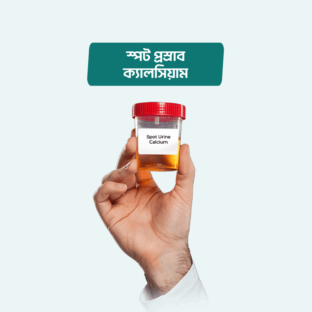 Spot Urine Calcium