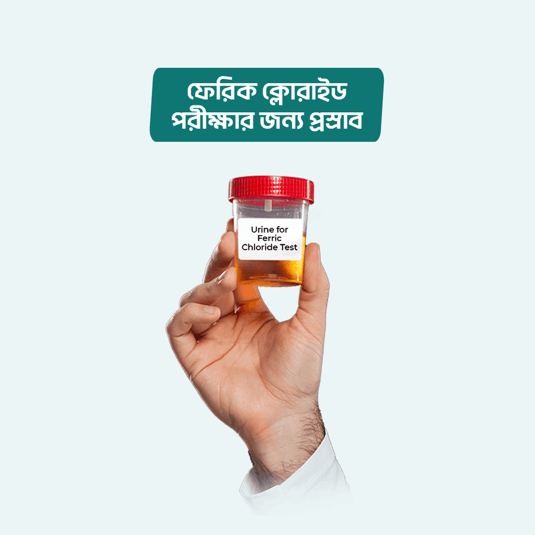 Urine for Ferric Chloride Test