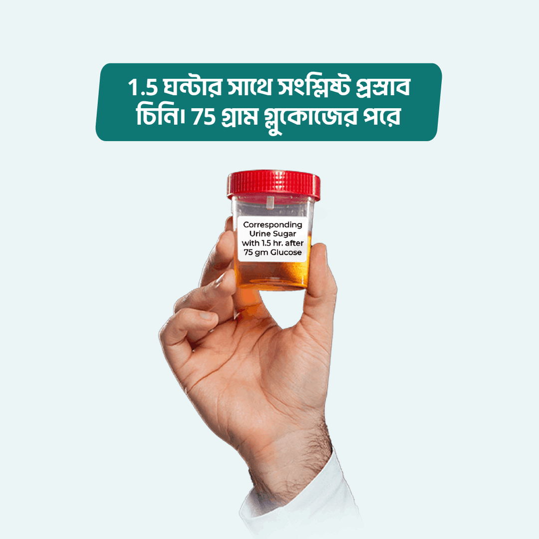 Corresponding Urine Sugar with 1.5 hr. after 75 gm Glucose