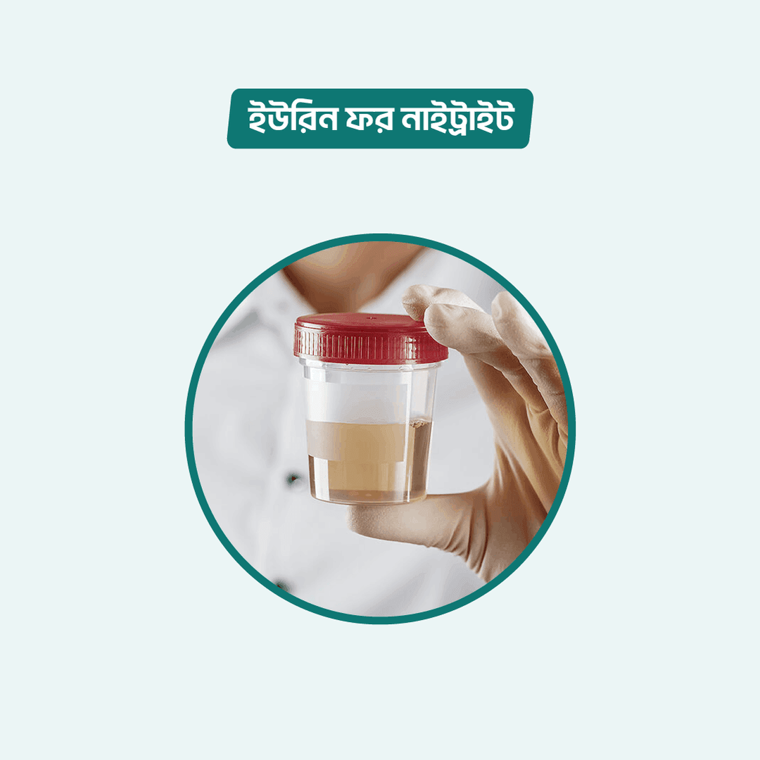 Urine For Nitrite