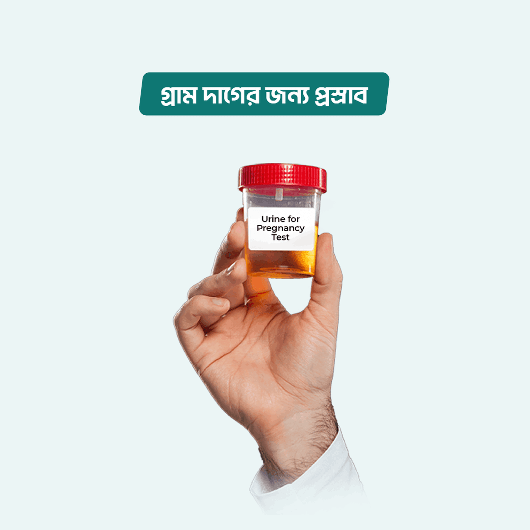 Urine for Gram Stain