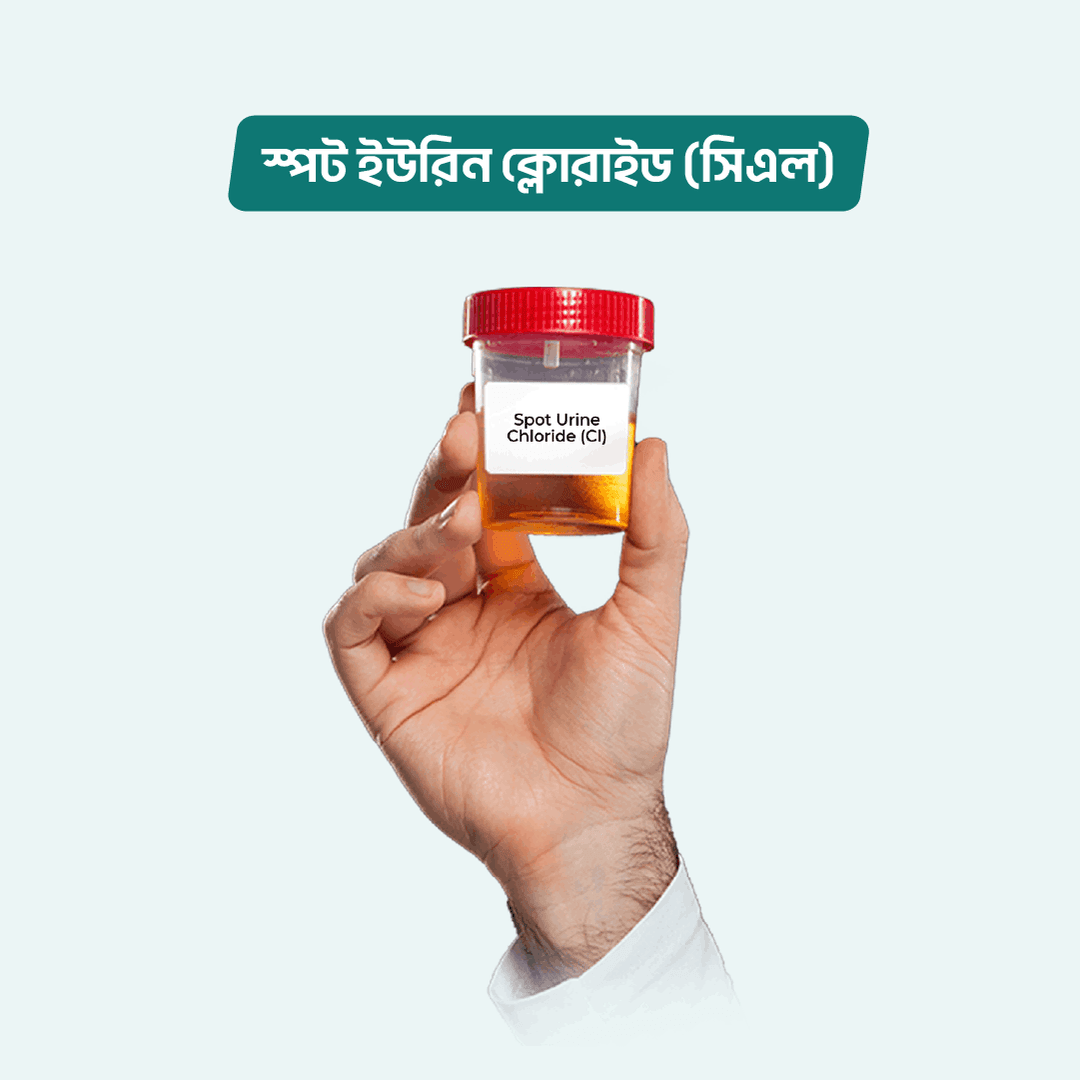 Spot Urine Chloride (Cl)/Chloride Urine test Online in Dhaka | Arogga ...