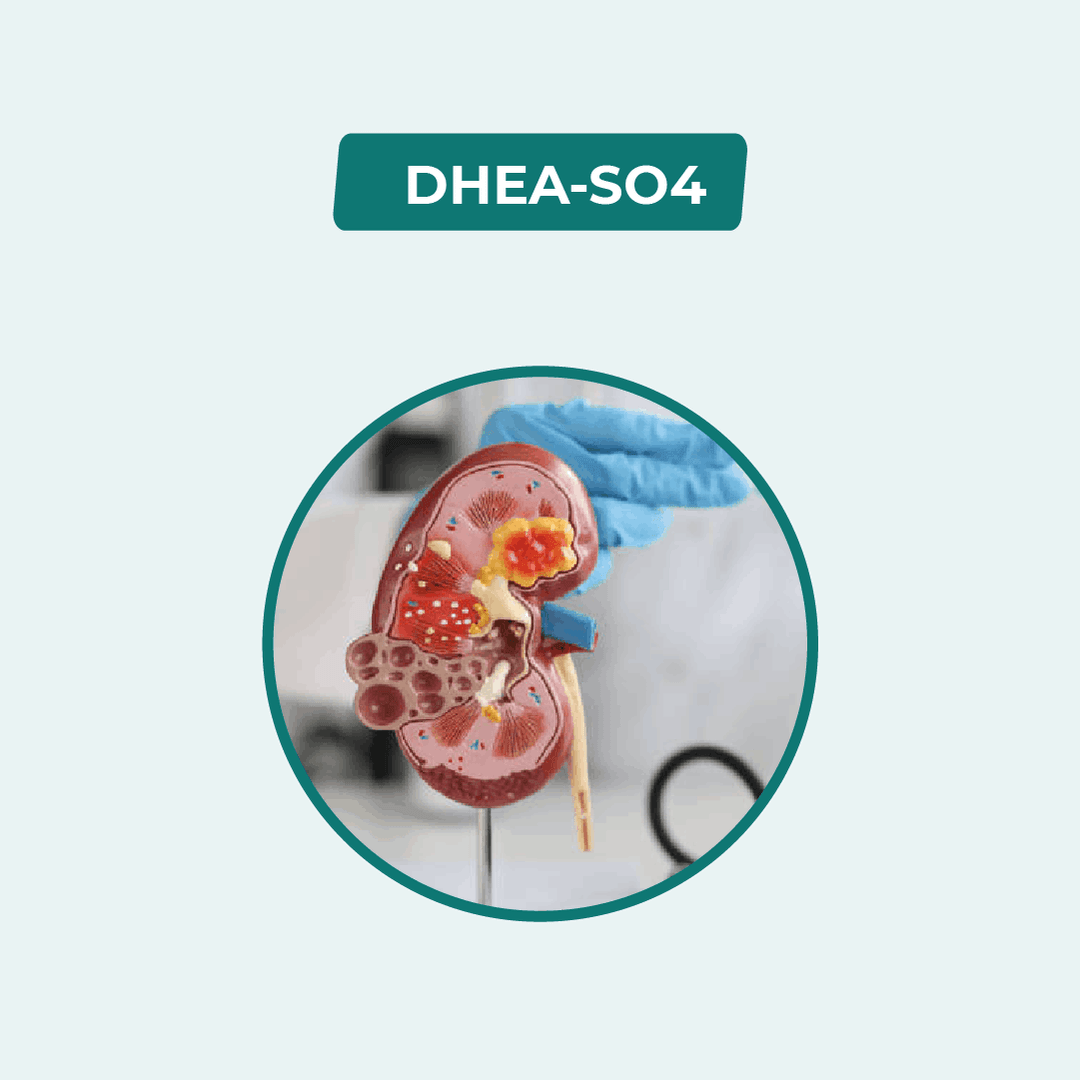 DHEA - SO4