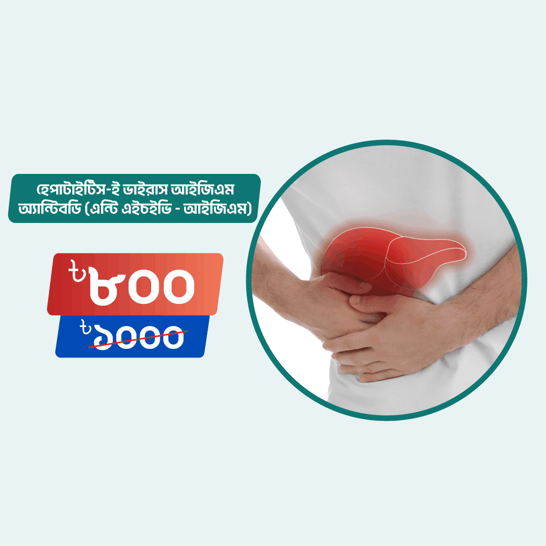 Hepatitis-E Virus IgM Antibody ( Anti HEV - IgM)