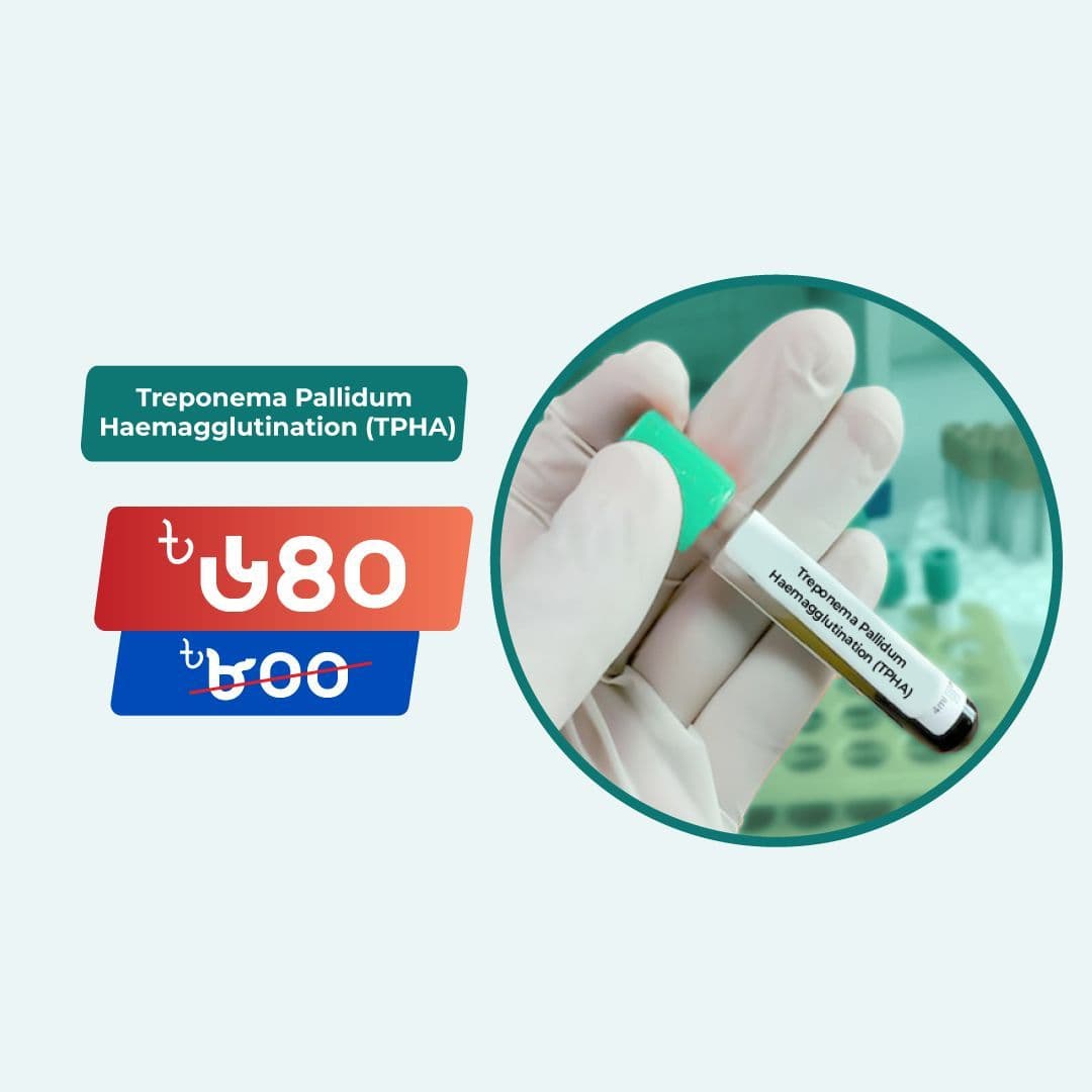 Treponema Pallidum Haemagglutination (TPHA)