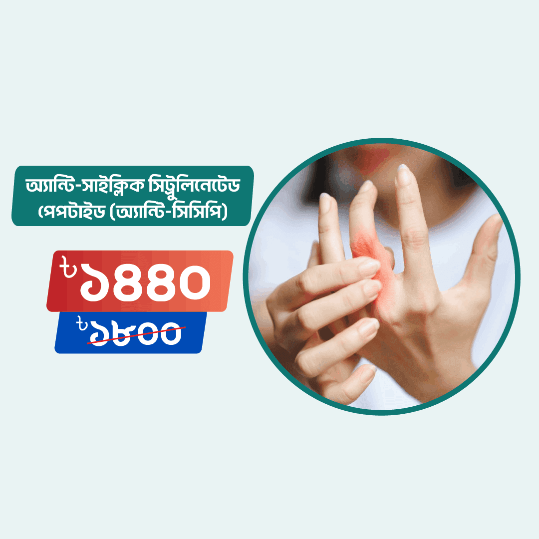 Anti-Cyclic Citrullinated Peptide (Anti-CCP)